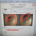 “司女士厦门采耳遭遇意外，店家只赔医药费不认赔偿责任？